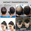 THICK FIBER - Hair Fibers for Thinning Hair (Black) 25g Bottle, Hair Loss concealer for Men & Women