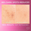 L’Oréal Paris Melasyl Glycolic Acid and Anti Dark Spot Face Serum with Niacinamide, Instant Glow 30 ml