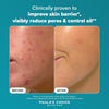 Paula's Choice SKIN PERFECTING 2% BHA Liquid Exfoliant - Face Exfoliating Peel Fights Blackheads & Enlarged Pores - with Salicylic Acid - Combination & Oily Skin - 30 ml