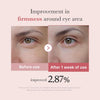 medicube Salmon DNA PDRN Pink Peptide Eye Serum, Niacinamide and 99% Pure Retinol Eye Cream for Fine Lines, Dark Circles, Korean Skin Care 1.01fl.oz