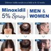 Nigwedete Minoxidil 5% for Men (120 ML), Advanced Minoxidil Spray with Provitamin B5 and Castor Seed Extract, Minoxidil Extract Serum for Hair Loss, Beard Restoration