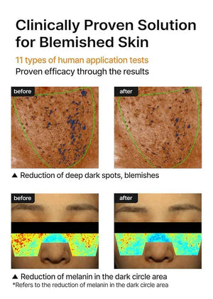 CELIMAX - Pore + Dark Spot Brightening Cream