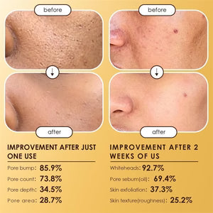 Moolinse Peel Shot P5 Exfoliant Ampoule (Pack of 2) ℗
